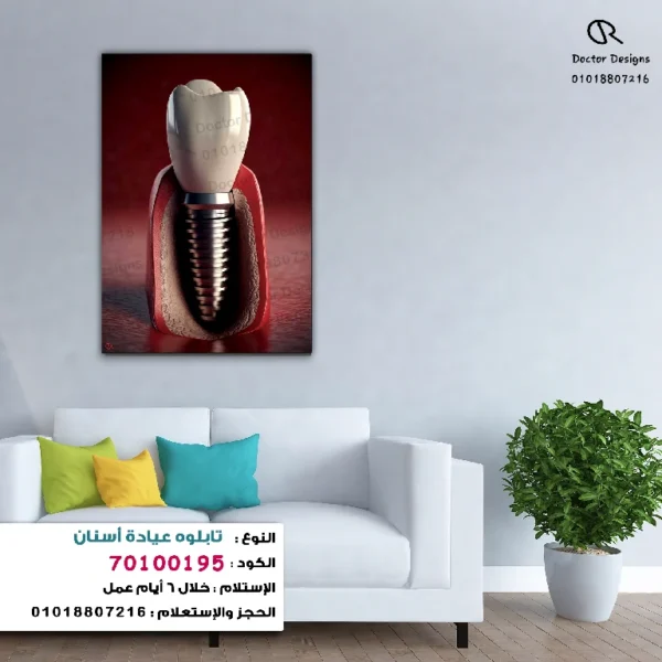 تابلوه الكود:70100195