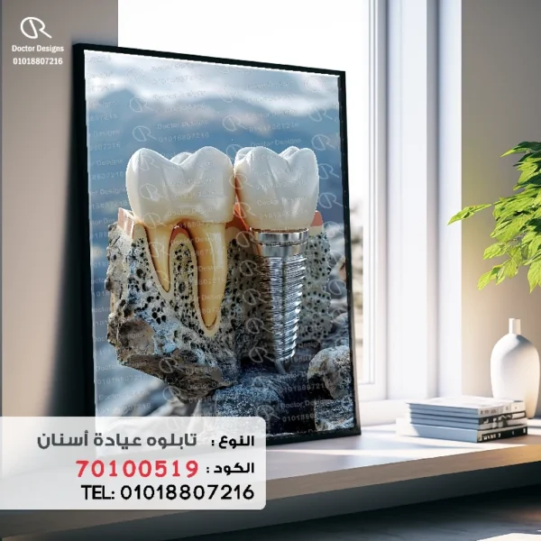 تابلوه الكود:70100519