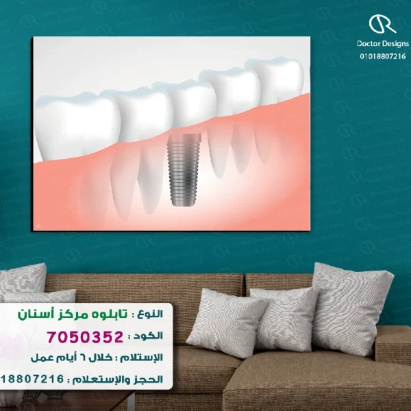 تابلوه الكود:7050352