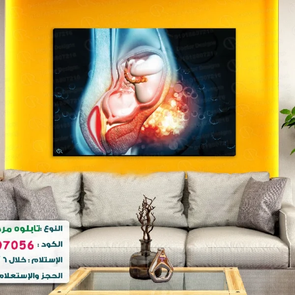 تابلوه الكود:1007056