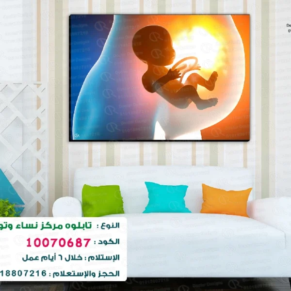 تابلوه الكود: 10070687